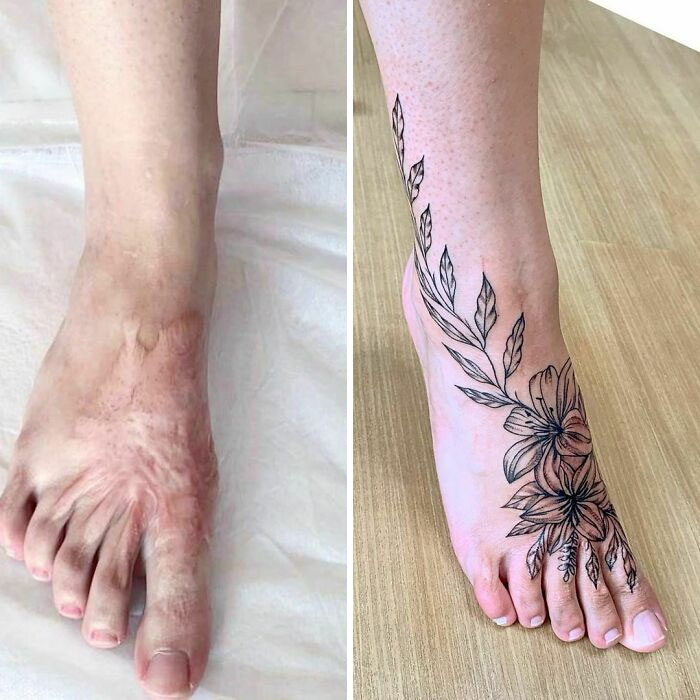 tatuaje-cicatrices4