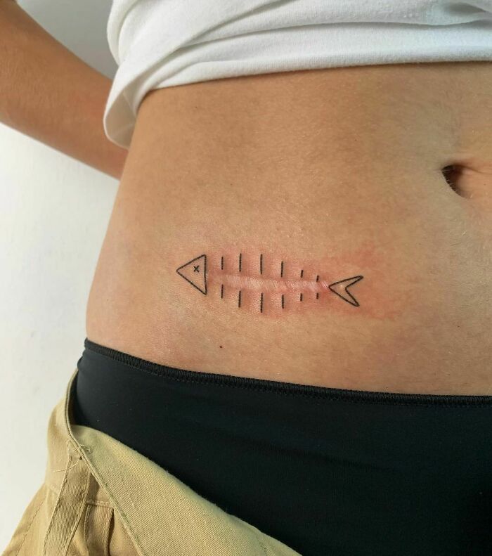 tatuaje-cicatrices5