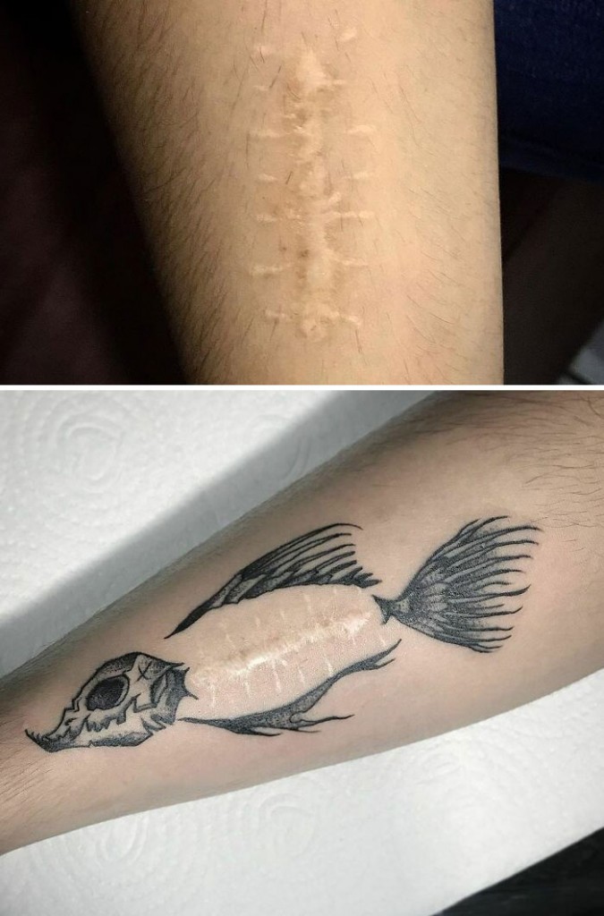 tatuaje-cicatrices8