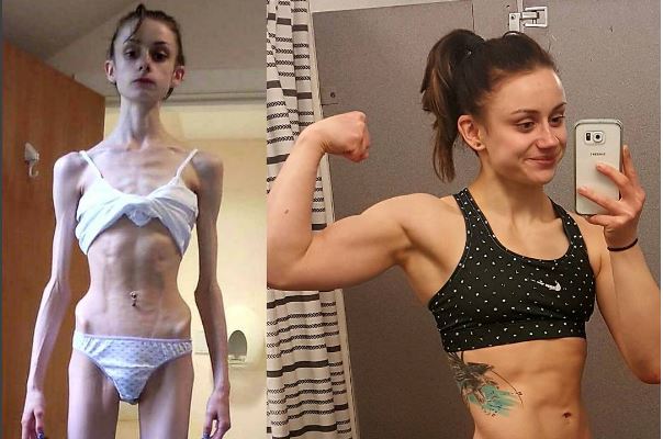Anorexia MMA