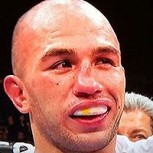 10 espeluznantes lesiones en el rostro de luchadores de artes marciales mixtas