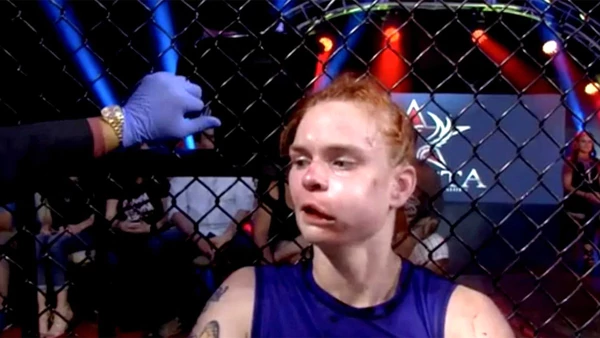 mujeres rostro mma 1