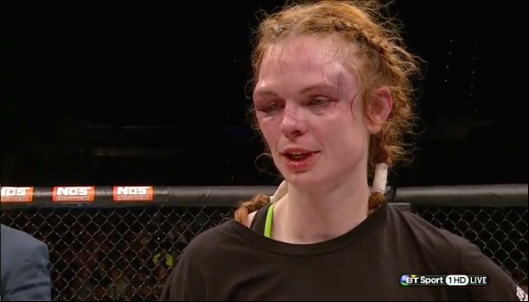 mujeres rostro mma 15