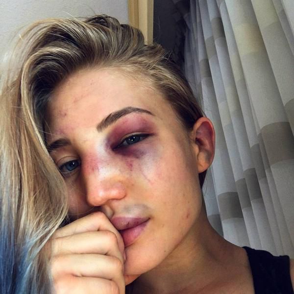 mujeres rostro mma 3