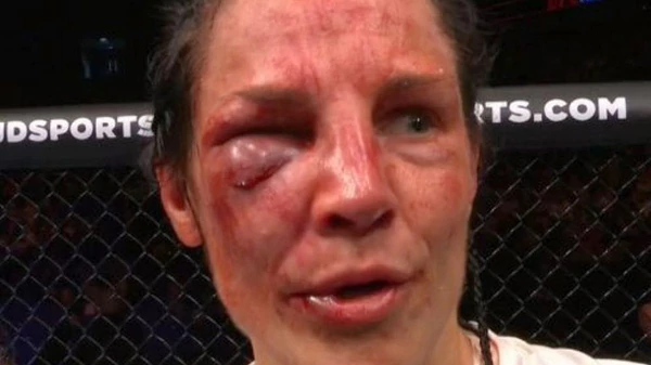 mujeres rostro mma 5