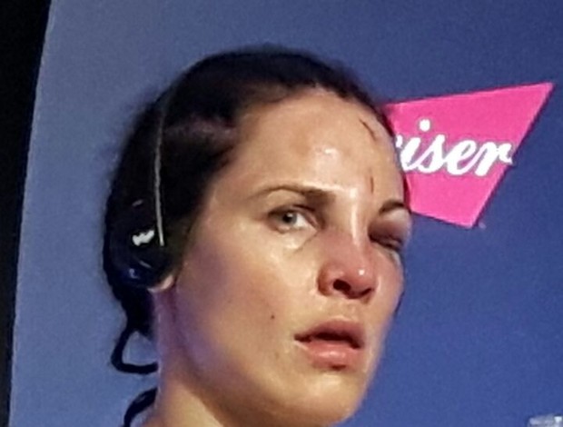 mujeres rostro mma 6