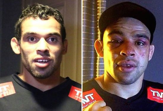 antes y despues 9