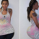 La “Doctora Cemento”: Inyectaba el producto en los glúteos de sus pacientes