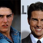Dientes de famosos: Antes y después con impresionantes cambios en sus sonrisas