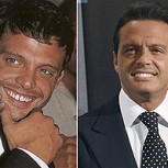 Dientes de famosos: Antes y después con impresionantes cambios en sus sonrisas (II)