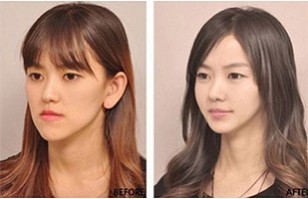 Cirugías extremas: Corea del Sur entrega certificados de identidad tras ...