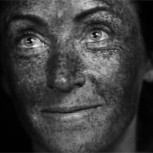 Impactante video muestra el efecto del exceso de sol en la piel