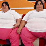 Impactante descenso de peso de mellizas: pesaban más de 400 kilos entre las dos