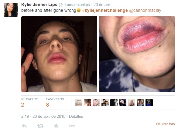 Kylie labios 4