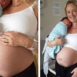 Madre publica fotos de su cuerpo posparto y causa revuelo en redes sociales