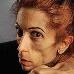 Rachael Farrokh: Impactante recuperación de la anorexia que la llevó a pesar 18 kilos