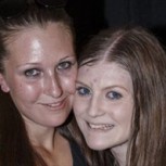 Hermanas con anorexia competían para ver quién era la más delgada: escalofriante caso