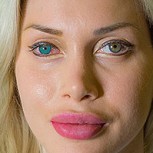 Modelo sueca se puso implantes en los ojos para lucir como dibujo animado