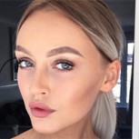 Ex bailarina perdió su cabello tras usar moños apretados por años