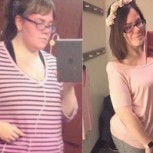 Esta joven logró drástico adelgazamiento, pero tiene un nuevo problema: le sobran 10 kg de piel