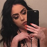 Muchacha con vitiligo convirtió su cuerpo en una obra de arte y sus fotos son furor
