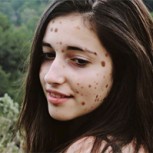Esta joven tiene 16 años, fue tildada de ‘monstruo’ y hoy se luce como modelo