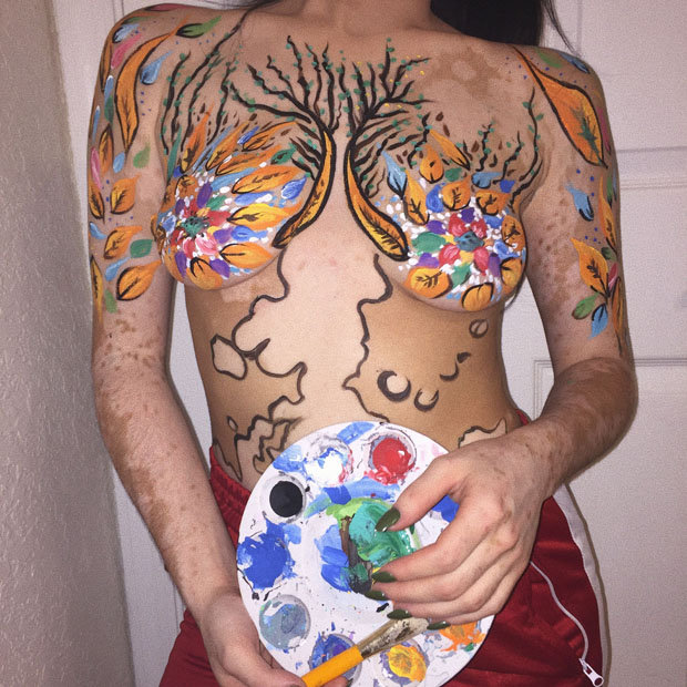 vitiligo-casos-cuerpo-pintado-4