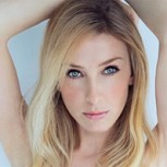 Joven californiana sorprende con extraña condición: tiene la piel de dos colores