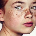 Las mejores fotos de gente pecosa: fotógrafo retrató a decenas para mostrar su belleza única