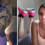 56 dramáticas fotos del antes y después de personas que vencieron a la anorexia: Los cambios son brutales