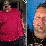 10 fotos del antes y después de personas con obesidad mórbida: Tras adelgazar, parecen otros