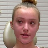 Niña de 11 años se sometió a cirugía estética para evitar burlas y encendió la polémica