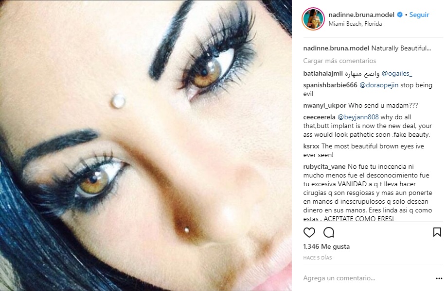 nadinne-bruna-cirugia-ojos-1