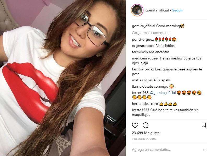gomita antes y despues de sus cirugias 2