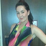 Mujer se inyectó Botox durante 10 años: Nunca imaginó lo que le iba a pasar