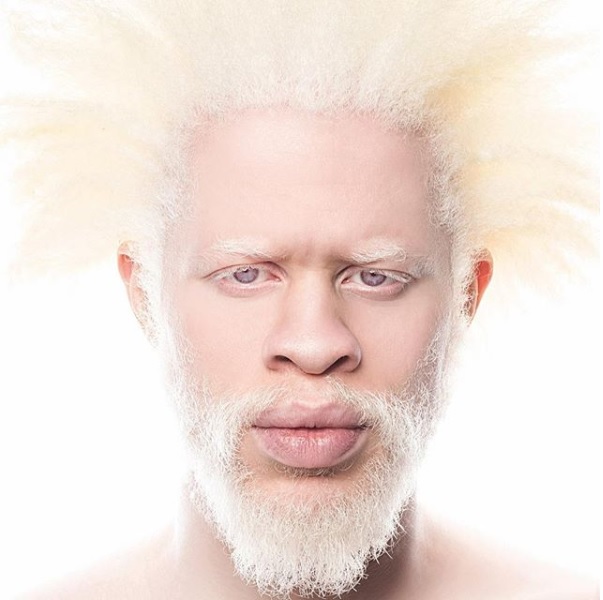 modelo albino