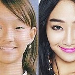 Famosas coreanas con cirugía plástica: Fotos antes y después muestran cambios brutales