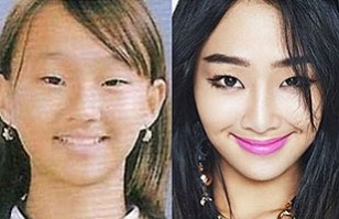Famosas coreanas con cirug&iacute;a pl&aacute;stica: Fotos antes y despu&eacute;s muestran cambios brutales