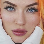 Experta en belleza quiso tatuarse pecas, pero el resultado fue un absoluto desastre