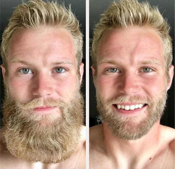 hombres con barba antes y despues 9
