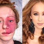 El hada madrina del maquillaje: Rusa hace sorprendentes transformaciones a mujeres con quemaduras