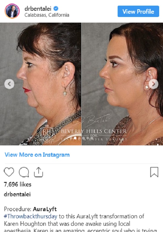 hermana de kris jenner cirugia Karen Houghton