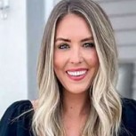 Influencer de belleza sufre desastre estético tras aplicarse Botox: Se le cayó un párpado