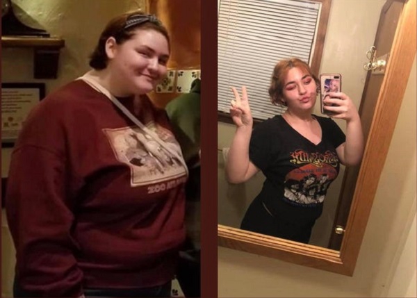 fotos antes y despues bajar de peso 9