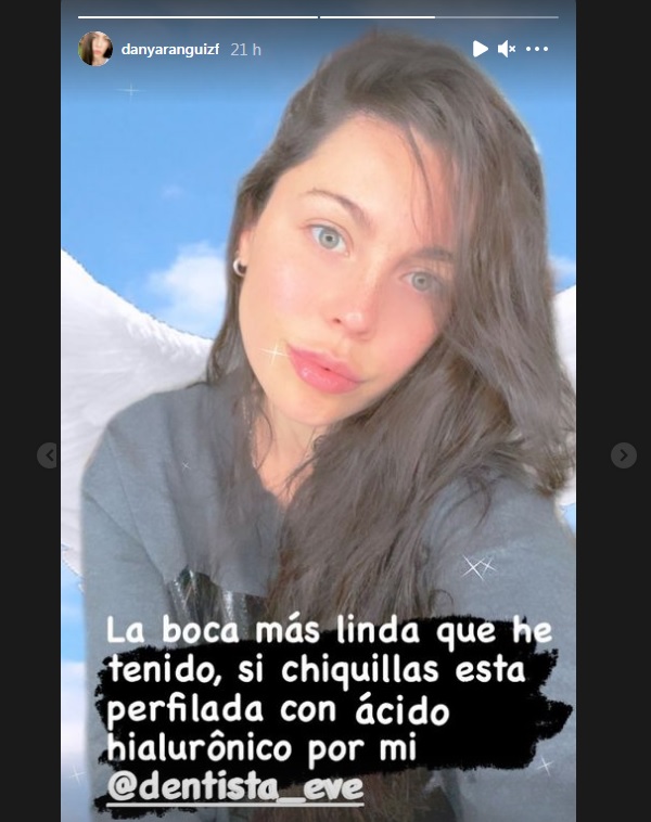 Daniela Aranguiz labios relleno acido hialuronico