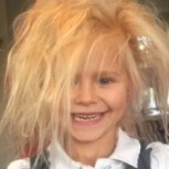 Síndrome del cabello impeinable: Fotos de niños que padecen este extraño mal