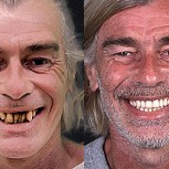 Dentista arregló las dentaduras de estas personas: Fotos antes y después del impactante cambio