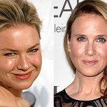 Renee Zellweger sorprende con impactante cambio en su rostro tras cirugía