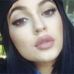 Kylie Jenner sorprende a sus fans reconociendo que sus labios son falsos