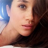 La nariz de Meghan Markle es la más pedida para realizar en cirugías estéticas
